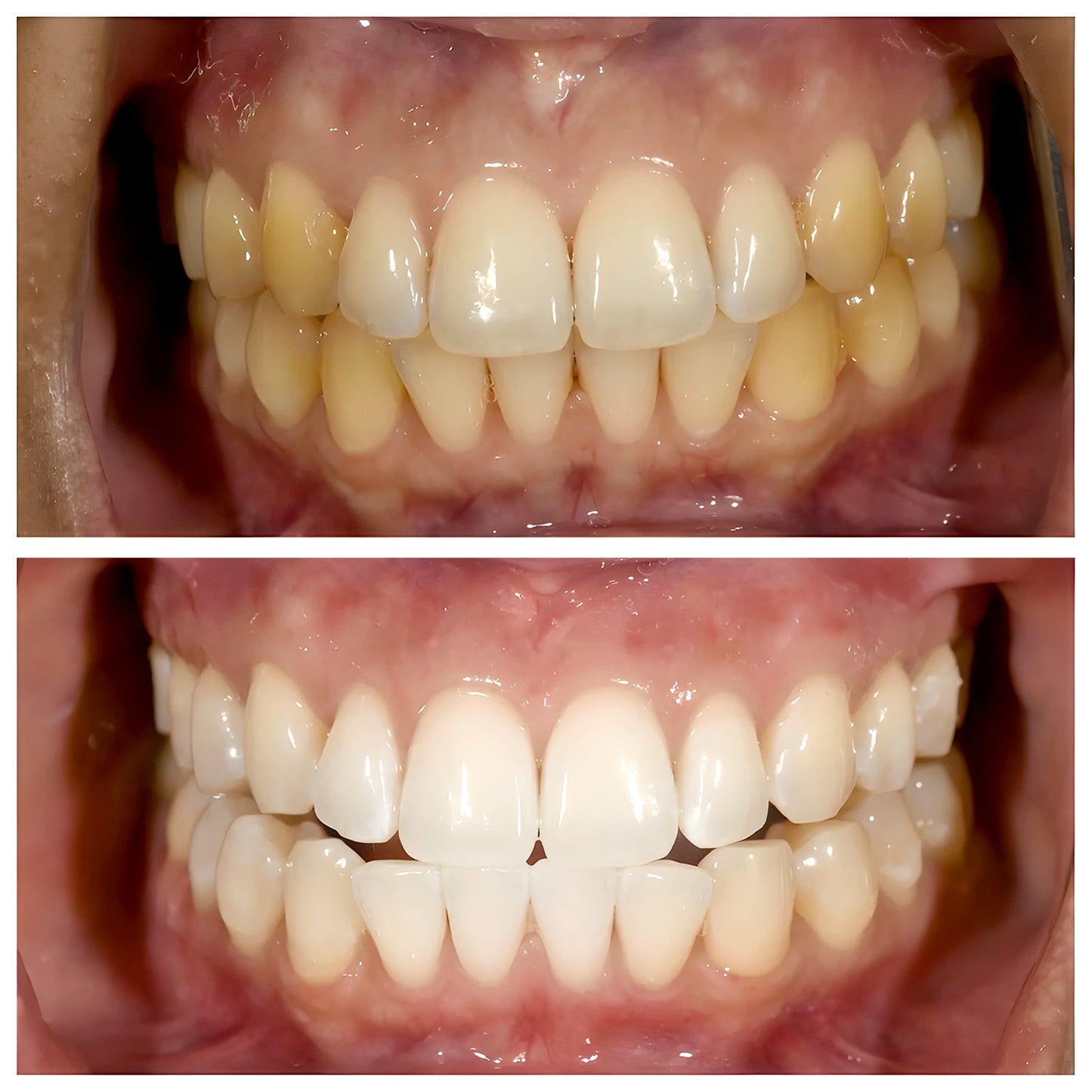 TriBright - Niacinamide Toothpaste