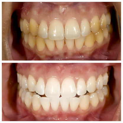 TriBright - Niacinamide Toothpaste